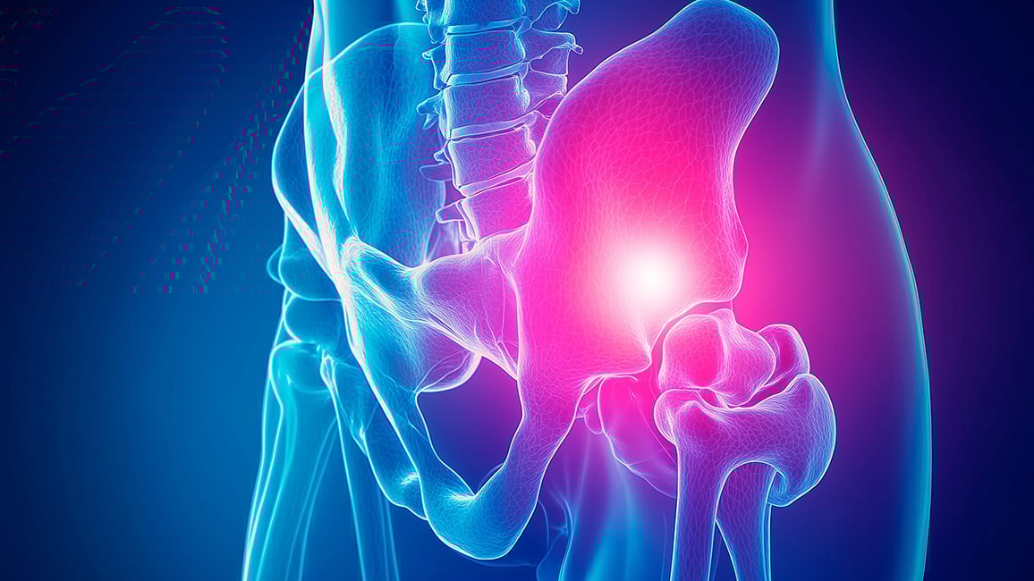 Piriformis Syndrome (T2)-banner-2